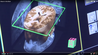 Screenshot from video displaying 3D imaging of a brain.