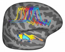 Graphic of brain hemisphere