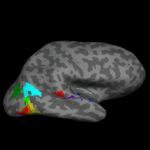 Functional MRI Investigations of the Human Brain