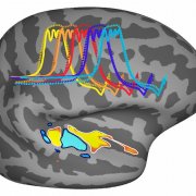 Graphic of brain hemisphere
