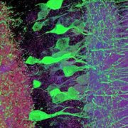 An image of neurons in a mouse hippocampus taken with expansion microscopy. Credit Ed Boyden, Fei Chen, Paul Tillberg/MIT