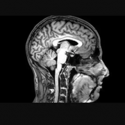 MRI view of human head/brain