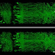 Using a new technique that allows them to enlarge brain tissue, MIT scientists created these images of neurons in the hippocampus. Image: Fei Chen and Paul Tillberg