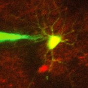Image: Ho-Jun Suk - In this image, a pipette guided by a robotic arm approaches a neuron identified with a fluorescent stain.  